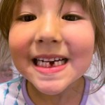 Selena's tooth